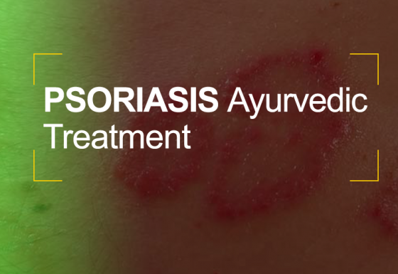 Psoriasis Ayurvedic Treatment in Kerala India