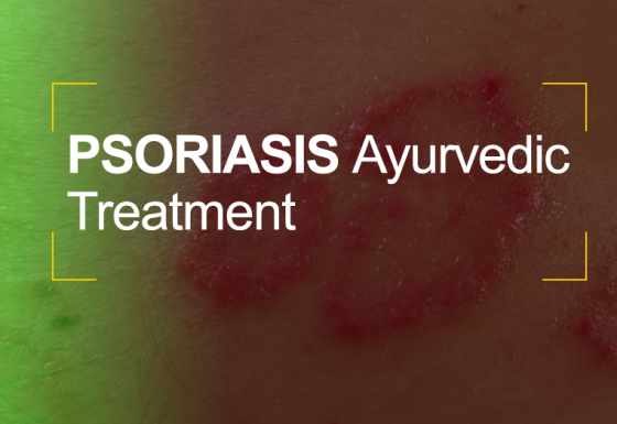 Psoriasis Ayurvedic Treatment in Kerala India @Matt India