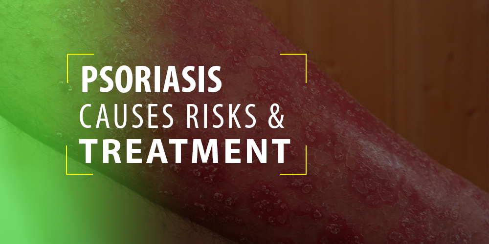 Psoriasis - Causes Risks & Ayurveda Treatment