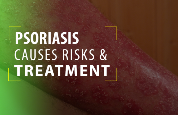 Psoriasis - Causes Risks & Ayurveda Treatment