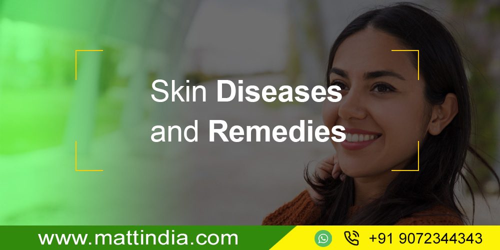 Skin Diseases and Remedies