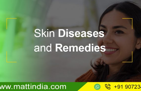 Skin Diseases and Remedies